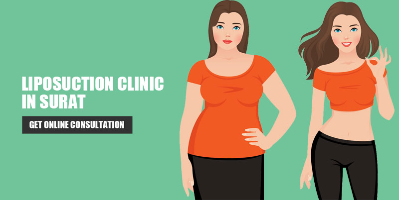 Liposuction Clinic in Surat